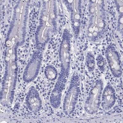 Immunohistochemistry-Paraffin: CYB5R2 Antibody [NBP2-62636] - Staining of human duodenum shows low expression as expected.