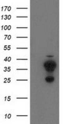 Western Blot CYB5R2 Antibody (OTI4B9) - Azide and BSA Free