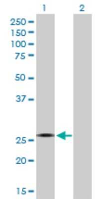 Western Blot: CYB5R2 Antibody [H00051700-B02P] - Analysis of CYB5R2 expression in transfected 293T cell line by CYB5R2 polyclonal antibody.  Lane 1: CYB5R2 transfected lysate(26.07 KDa). Lane 2: Non-transfected lysate.