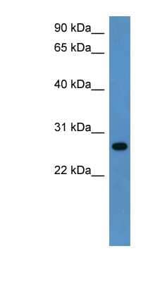 Western Blot: CYB5R2 Antibody [NBP1-79540] - Rat Lung lysate, concentration 0.2-1 ug/ml.