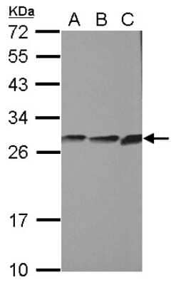 Western Blot: CYB5R2 Antibody [NBP2-16048] - Sample (30 ug of whole cell lysate) A: PC-3 B: U87-MG C: SK-N-SH 12% SDS PAGE gel, diluted at 1:1000.
