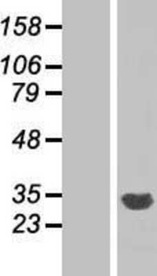 Western Blot: CYB5R2 Overexpression Lysate (Adult Normal) [NBP2-07068] Left-Empty vector transfected control cell lysate (HEK293 cell lysate); Right -Over-expression Lysate for CYB5R2.