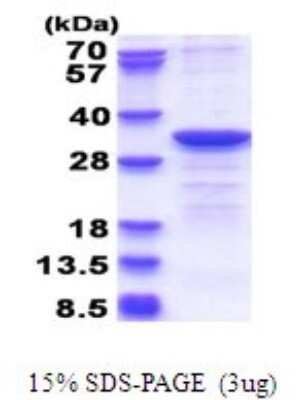 SDS-PAGE Recombinant Human CYB5R2 His Protein