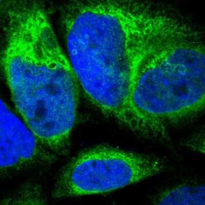 Immunocytochemistry/Immunofluorescence: CYB5R3 Antibody [NBP1-84252] - Staining of human cell line A-431 shows localization to endoplasmic reticulum. Antibody staining is shown in green.