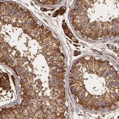 Immunohistochemistry-Paraffin: CYB5R3 Antibody [NBP1-84252] - Staining of human testis shows strong cytoplasmic positivity in cells in seminiferus ducts and Leydig cells.