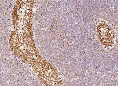 Immunohistochemistry-Paraffin: CYB5R3 Antibody [NBP3-06497] -  Staining of human CYB5R3 in human testis with rabbit polyclonal antibody at 1:10000 dilution.