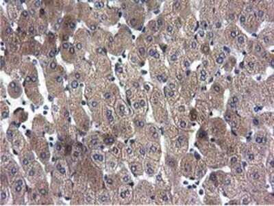 Immunohistochemistry: CYB5R3 Antibody (OTI2A10) - Azide and BSA Free [NBP2-70572] - Staining of paraffin-embedded Human liver tissue using anti-CYB5R3 mouse monoclonal antibody.