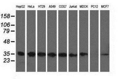 Western Blot: CYB5R3 Antibody (OTI2A10) - Azide and BSA Free [NBP2-70572] - Analysis of extracts (35ug) from 9 different cell lines by using anti-CYB5R3 monoclonal antibody.