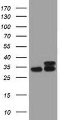 Western Blot: CYB5R3 Antibody (OTI2A10) - Azide and BSA Free [NBP2-70572] - HEK293T cells were transfected with the pCMV6-ENTRY control (Left lane) or pCMV6-ENTRY CYB5R3 (Right lane) cDNA for 48 hrs and lysed. Equivalent amounts of cell lysates (5 ug per lane) were separated by SDS-PAGE and immunoblotted with anti-CYB5R3.