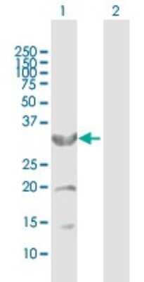 Western Blot: CYB5R3 Antibody [H00001727-B01P] - Analysis of CYB5R3 expression in transfected 293T cell line by CYB5R3 polyclonal antibody.  Lane 1: CYB5R3 transfected lysate(33.11 KDa). Lane 2: Non-transfected lysate.