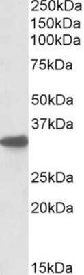 Western Blot: CYB5R3 Antibody [NBP1-51984] - Analysis of CYB5R3 in Mouse Liver lysate (RIPA buffer, 35ug total protein per lane) using NBP1-51984 at 0.1ug/ml. Primary incubated for 1 hour. Detected by western blot using chemiluminescence.