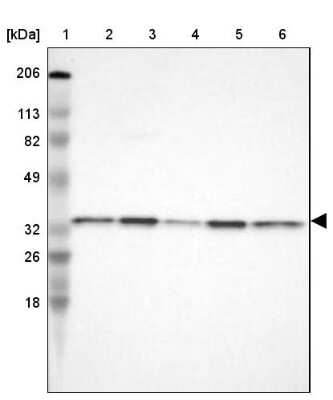 Western Blot CYB5R3 Antibody