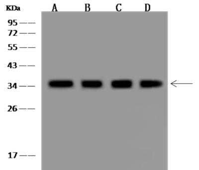 Western Blot CYB5R3 Antibody