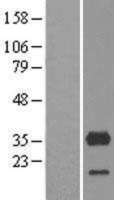 Western Blot: CYB5R3 Overexpression Lysate (Adult Normal) [NBL1-09654] Left-Empty vector transfected control cell lysate (HEK293 cell lysate); Right -Over-expression Lysate for CYB5R3.