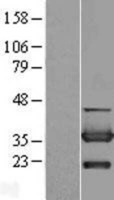 Western Blot: CYB5R3 Overexpression Lysate (Adult Normal) [NBL1-09655] Left-Empty vector transfected control cell lysate (HEK293 cell lysate); Right -Over-expression Lysate for CYB5R3.