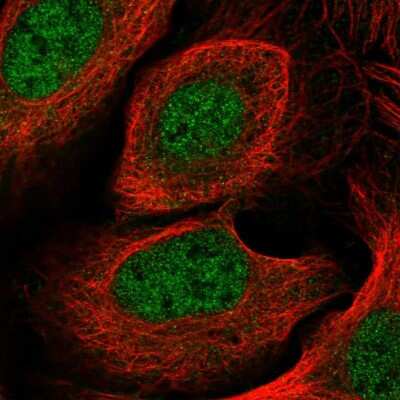Immunocytochemistry/Immunofluorescence: CYB5RL Antibody [NBP2-13889] - Immunofluorescent staining of human cell line U-2 OS shows localization to nucleoplasm.