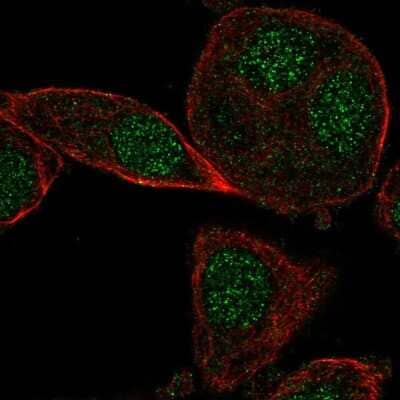 Immunocytochemistry/ Immunofluorescence CYB5RL Antibody - BSA Free