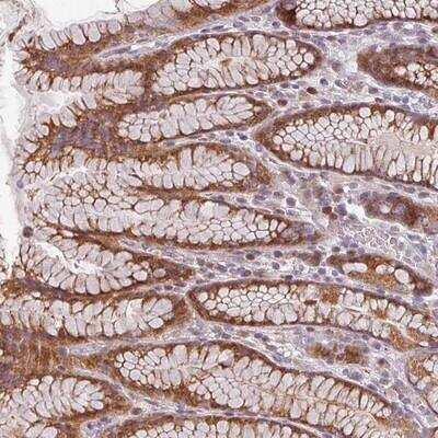 Immunohistochemistry-Paraffin: CYB5RL Antibody [NBP2-13889] - Staining of human stomach, upper shows moderate cytoplasmic positivity in glandular cells.
