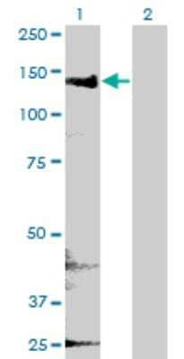 Western Blot: CYFIP2 Antibody (4G6) [H00026999-M01] - Analysis of CYFIP2 expression in transfected 293T cell line by CYFIP2 monoclonal antibody (M01), clone 4G6.Lane 1: CYFIP2 transfected lysate(145.7 KDa).Lane 2: Non-transfected lysate.