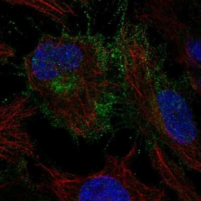 Immunocytochemistry/Immunofluorescence: CYFIP2 Antibody [NBP2-57502] - Staining of human cell line HeLa shows localization to plasma membrane & cytosol.