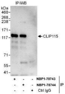 Immunoprecipitation: CYLN2 Antibody [NBP1-78743] - Whole cell lysate (1 mg for IP, 20% of IP loaded) from HeLa cells.  Affinity purified rabbit anti-CLIP115 antibody  used for IP at 6 mcg/mg lysate.  CLIP115 was also immunoprecipitated by rabbit anti-CLIP115 antibody NBP1-78744 which recognizes a downstream epitope.