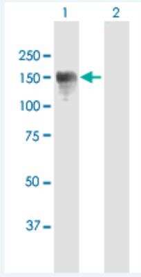 Western Blot: CYLN2 Antibody [H00007461-B01P-50ug] - Analysis of CLIP2 expression in transfected 293T cell line (H00007461-T01) by CLIP2 MaxPab polyclonal antibody.  Lane 1: CLIP2 transfected lysate(115.06 KDa). Lane 2: Non-transfected lysate.