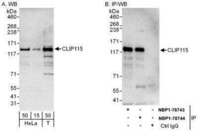 Western Blot: CYLN2 Antibody [NBP1-78744] - Whole cell lysate from HeLa (15 and 50 mcg for WB; 1 mg for IP, 20% of IP loaded) and 293T (T; 50 mcg) cells.   Affinity purified rabbit anti-CLIP115 antibody used for WB at 0.1 mcg/ml (A) and 1 mcg/ml (B) and used for IP at 6 mcg/mg lysate.  CLIP115 was also immunoprecipitated by rabbit anti-CLIP115 antibody which recognizes an upstream epitope.