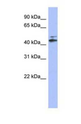 Western Blot: CYP20A1 Antibody [NBP1-69680] - This Anti-CYP20A1 antibody was used in Western Blot of Fetal Lung tissue lysate at a concentration of 1ug/ml.