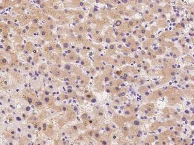 Immunohistochemistry-Paraffin: CYP21A2 Antibody [NBP2-99116] - Immunochemical staining of human CYP21A2 in human liver with rabbit polyclonal antibody at 1:300 dilution, formalin-fixed paraffin embedded sections.