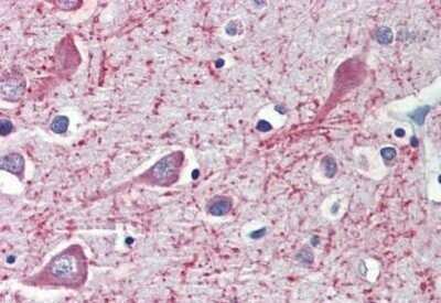 Immunohistochemistry-Paraffin: CYP26A1 Antibody [NBP1-52388] - Staining of human brain, cortex. Immunohistochemistry of formalin-fixed, paraffin-embedded tissue after heat-induced antigen retrieval. Antibody concentration 3.75 ug/ml.