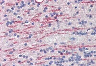 Immunohistochemistry-Paraffin: CYP26A1 Antibody [NBP1-52388] - Analysis of anti-CYP26A1 antibody with human brain, cerebellum, white matter at concentration 3.75 ug/ml.
