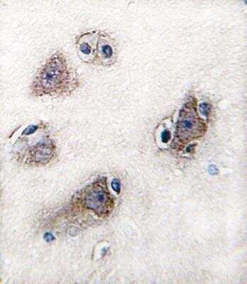 Immunohistochemistry-Paraffin: CYP26C1 Antibody [NBP3-06730] - Formalin-fixed and paraffin-embedded human brain tissue reacted with CYP26C1 antibody , which was peroxidase-conjugated to the secondary antibody, followed by DAB staining. 