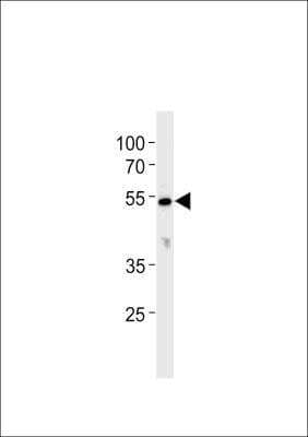 Western Blot: CYP26C1 Antibody [NBP3-06730] - Analysis in K562 cell line lysates (35ug/lane). 