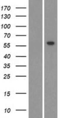 Western Blot: CYP26C1 Overexpression Lysate (Adult Normal) [NBP2-04787] Left-Empty vector transfected control cell lysate (HEK293 cell lysate); Right -Over-expression Lysate for CYP26C1.