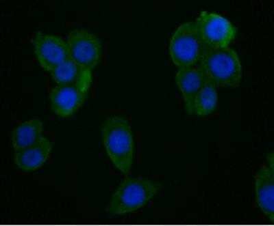 Immunocytochemistry/Immunofluorescence: CYP27A1 Antibody (JG40-36) [NBP2-76827] - Staining of CYP27A1 in LOVO cells (green). The nuclear counter stain is DAPI (blue). Cells were fixed in paraformaldehyde, permeabilised with 0.25% Triton X-100/PBS.