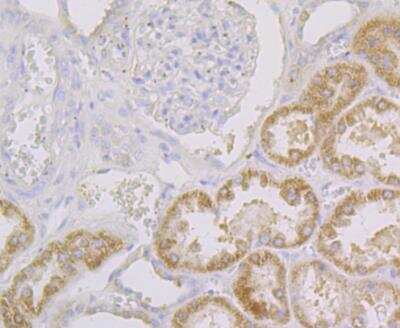Immunohistochemistry: CYP27A1 Antibody (JG40-36) [NBP2-76827] - Immunohistochemical analysis of paraffin-embedded human kidney tissue using anti-CYP27A1 antibody. Counter stained with hematoxylin.
