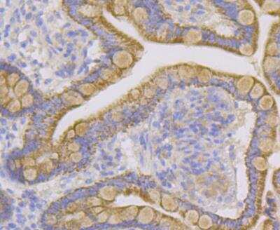 Immunohistochemistry: CYP27A1 Antibody (JG40-36) [NBP2-76827] - Immunohistochemical analysis of paraffin-embedded human small intestine tissue using anti-CYP27A1 antibody. Counter stained with hematoxylin.