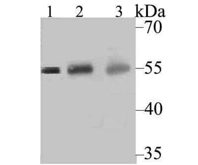 Western Blot: CYP27A1 Antibody (JG40-36) [NBP2-76827] - Analysis of CYP27A1 on different tissue lysates using anti-CYP27A1 antibody at 1:500 dilution. Positive control: Lane 1: Rat heart. Lane 2: Human liver. Lane 2: Human kidney.