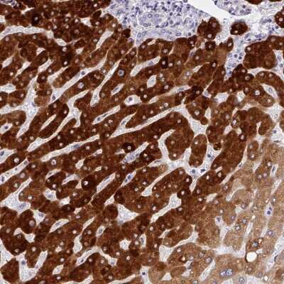 Immunohistochemistry: CYP2A13 Antibody [NBP2-33467] - Staining of human liver shows strong cytoplasmic positivity in hepatocytes.