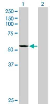 Western Blot: CYP2A7 Antibody [H00001549-D01P] - Analysis of CYP2A7 expression in transfected 293T cell line by CYP2A7 polyclonal antibody.Lane 1: CYP2A7 transfected lysate(56.40 KDa).Lane 2: Non-transfected lysate.