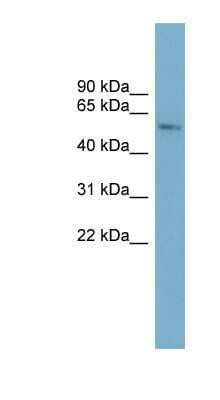 Western Blot: CYP2A7 Antibody [NBP1-62682] - ACHN cell lysate, concentration 0.2-1 ug/ml.