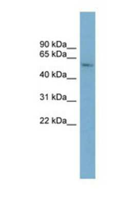 Western Blot: CYP2A7 Antibody [NBP1-69676] - This Anti-CYP2A7 antibody was used in Western Blot of ACHN     tissue lysate at a concentration of 1ug/ml.