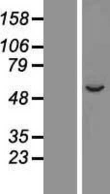 Western Blot: CYP2A7 Overexpression Lysate (Adult Normal) [NBP2-06209] Left-Empty vector transfected control cell lysate (HEK293 cell lysate); Right -Over-expression Lysate for CYP2A7.