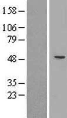 Western Blot: CYP2A7 Overexpression Lysate (Adult Normal) [NBP2-08997] Left-Empty vector transfected control cell lysate (HEK293 cell lysate); Right -Over-expression Lysate for CYP2A7.