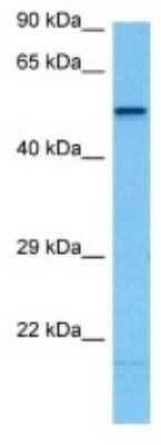 Western Blot: CYP2C70 Antibody [NBP3-10165] - Western blot analysis of CYP2C70 in Mouse Thymus lysates. Antibody dilution at 1ug/ml
