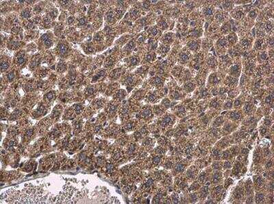 Immunohistochemistry-Paraffin: CYP2R1 Antibody [NBP1-32883] - Mouse liver. Cytochrome P450 2R1 antibody [N1C2] diluted at 1:500. Antigen Retrieval: Citrate buffer, pH 6.0, 15 min.