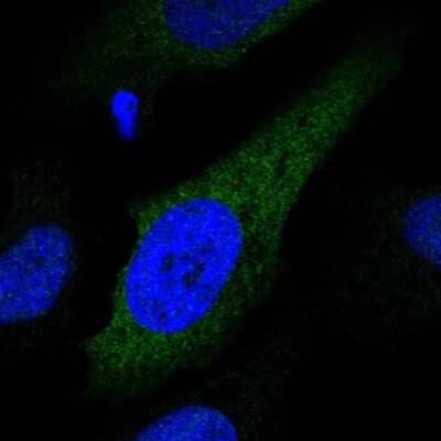 Immunocytochemistry/ Immunofluorescence CYP2S1 Antibody