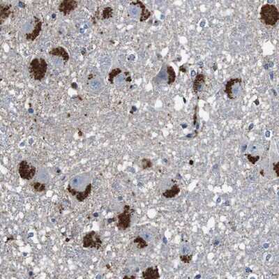 Immunohistochemistry-Paraffin: CYP2W1 Antibody [NBP1-83659] - Staining of human hippocampus shows strong cytoplasmic positivity, with a granular pattern, in neuronal and glial cells.