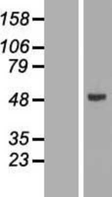 Western Blot: CYP2W1 Overexpression Lysate (Adult Normal) [NBL1-09691] Left-Empty vector transfected control cell lysate (HEK293 cell lysate); Right -Over-expression Lysate for CYP2W1.