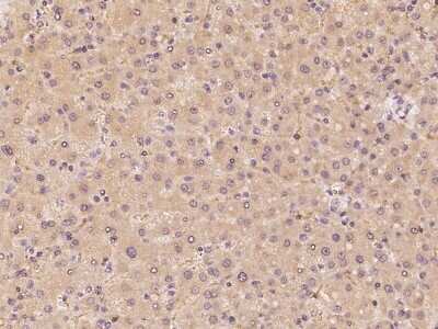 Immunohistochemistry: CYP39A1 Antibody [NBP2-97435] - Immunochemical staining of human CYP39A1 in human liver with rabbit polyclonal antibody at 1:100 dilution, formalin-fixed paraffin embedded sections.